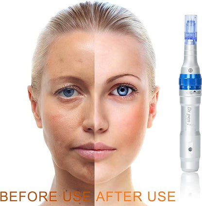 Dr. Pen  A6 Ultima Wireless Microneedling  DermaPen